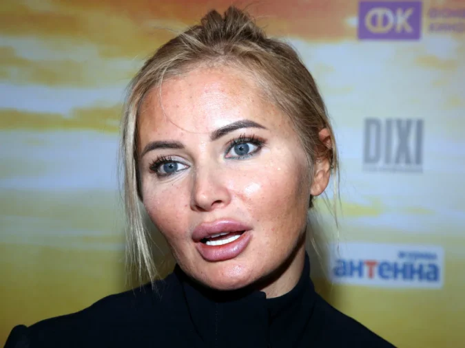 Дана Борисова высказалась о результатах пластики